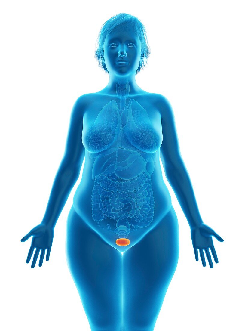 Illustration of an obese woman's bladder