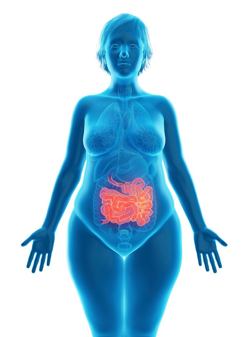 Illustration of an obese woman's small intestine