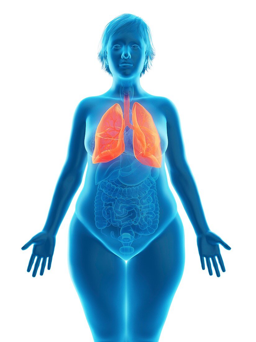 Illustration of an obese woman's lung