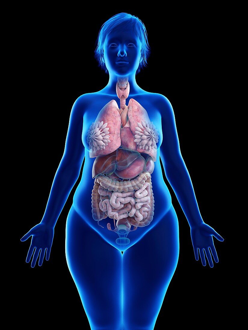 Illustration of an obese woman's internal organs