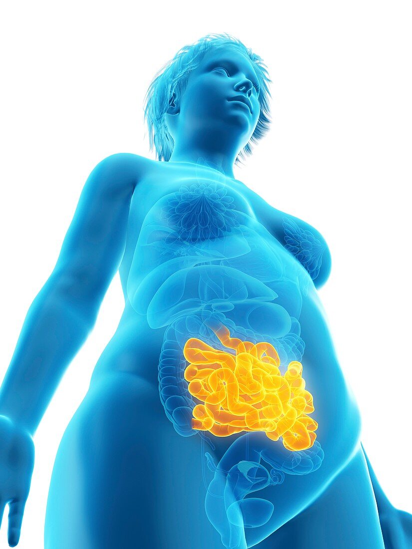 Illustration of an obese woman's small intestine