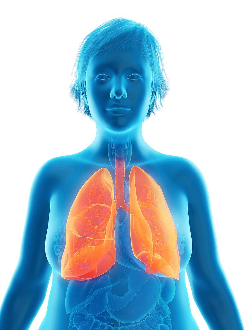 Illustration of an obese woman's lung