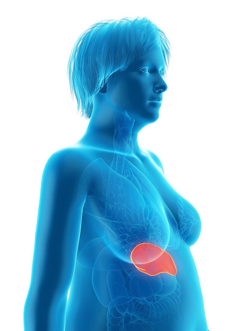 Illustration of an obese woman's spleen