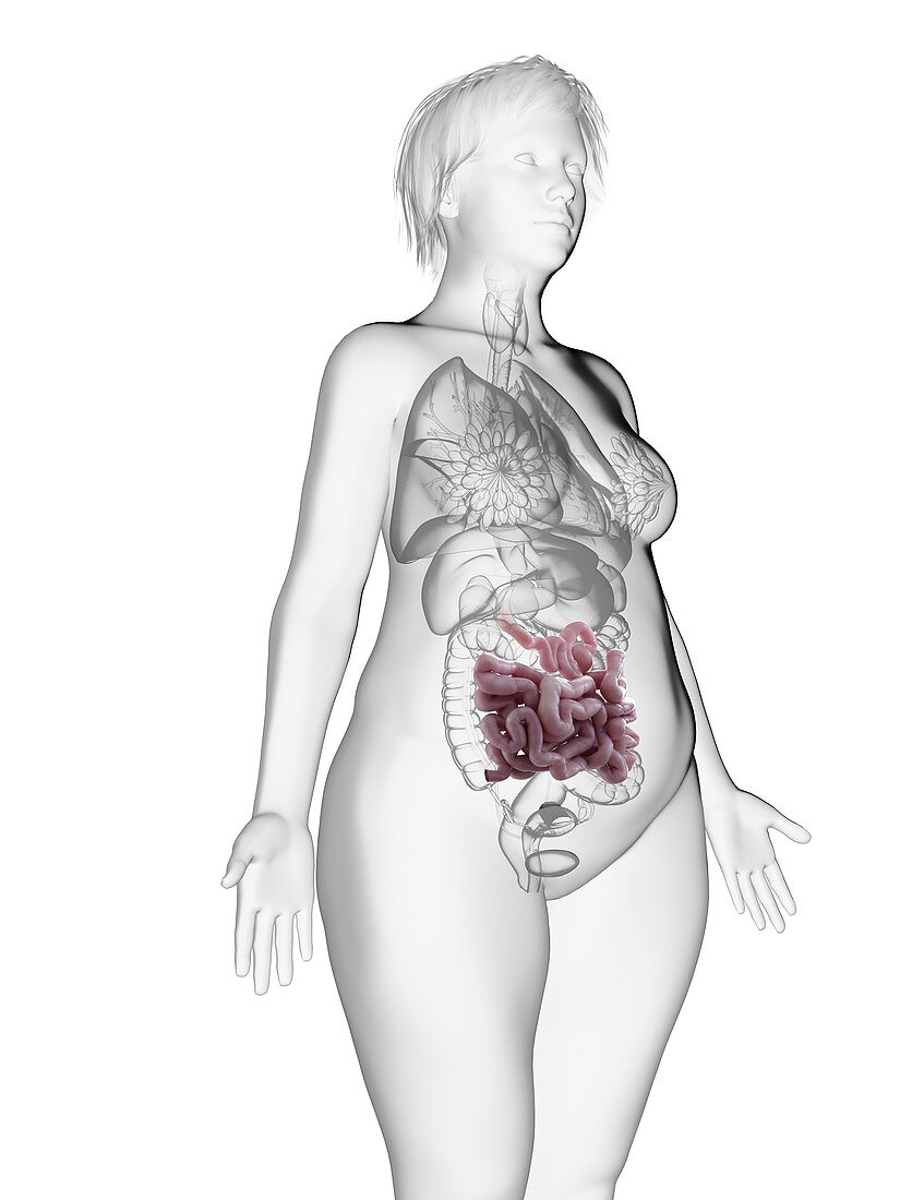 Illustration of an obese woman's small intestine