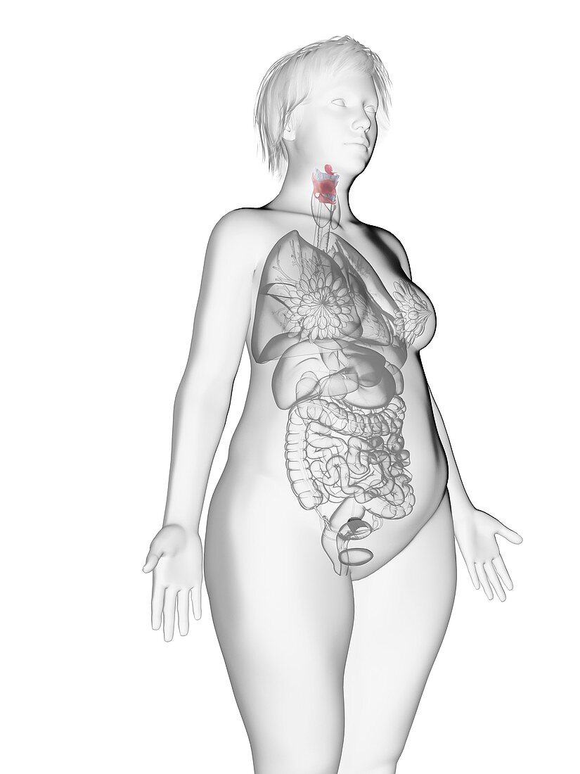 Illustration of an obese woman's larynx