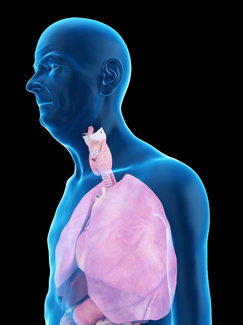 Illustration of an old man's lung