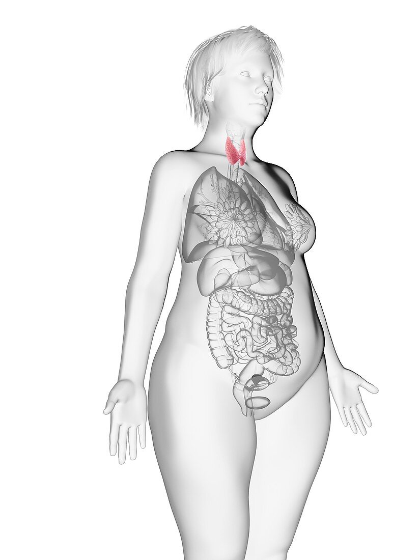 Illustration of an obese woman's thyroid gland