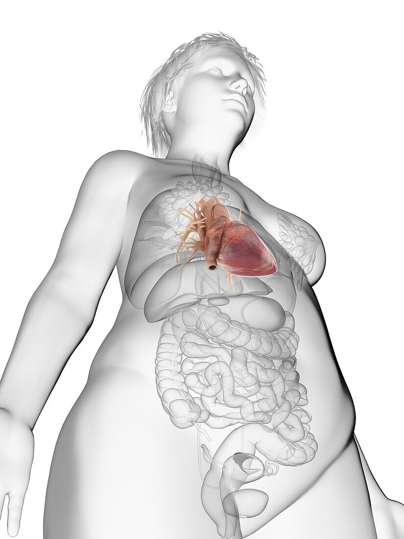 Illustration of an obese woman's heart