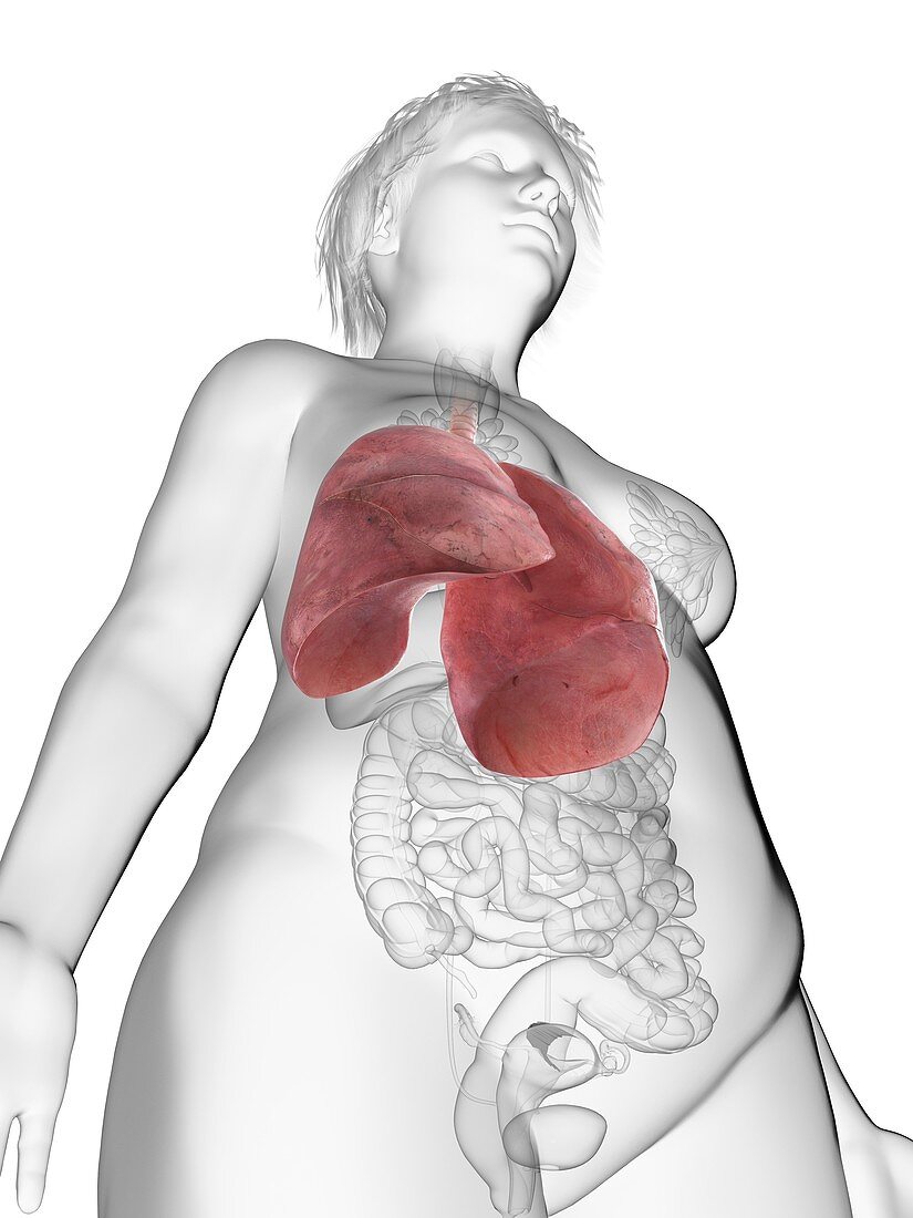 Illustration of an obese woman's lung