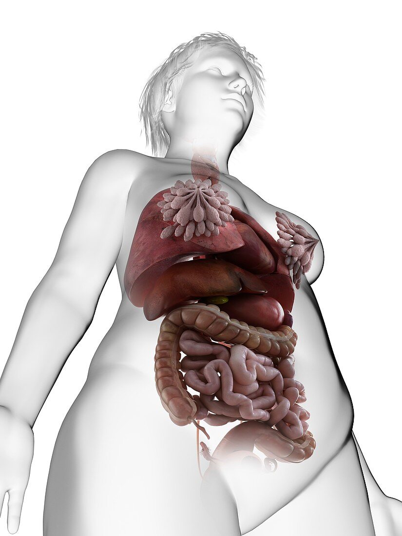 Illustration of an obese woman's internal organs