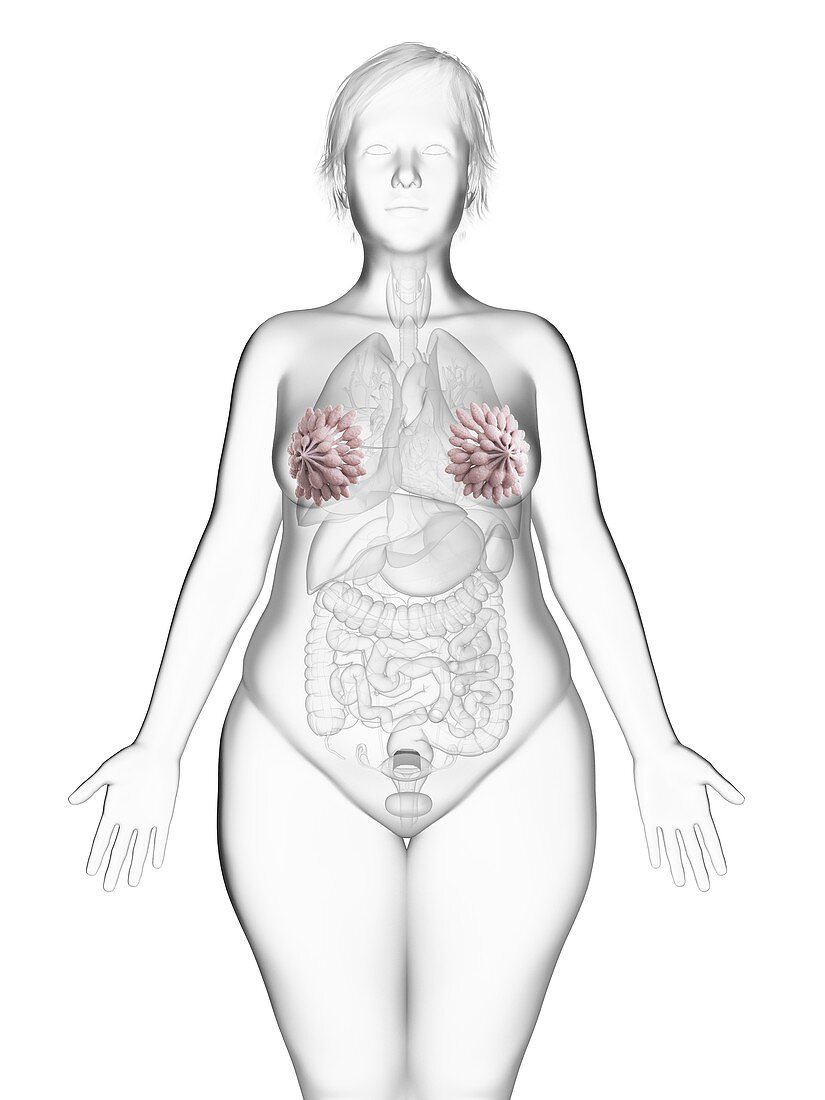 Illustration of an obese woman's mammary glands