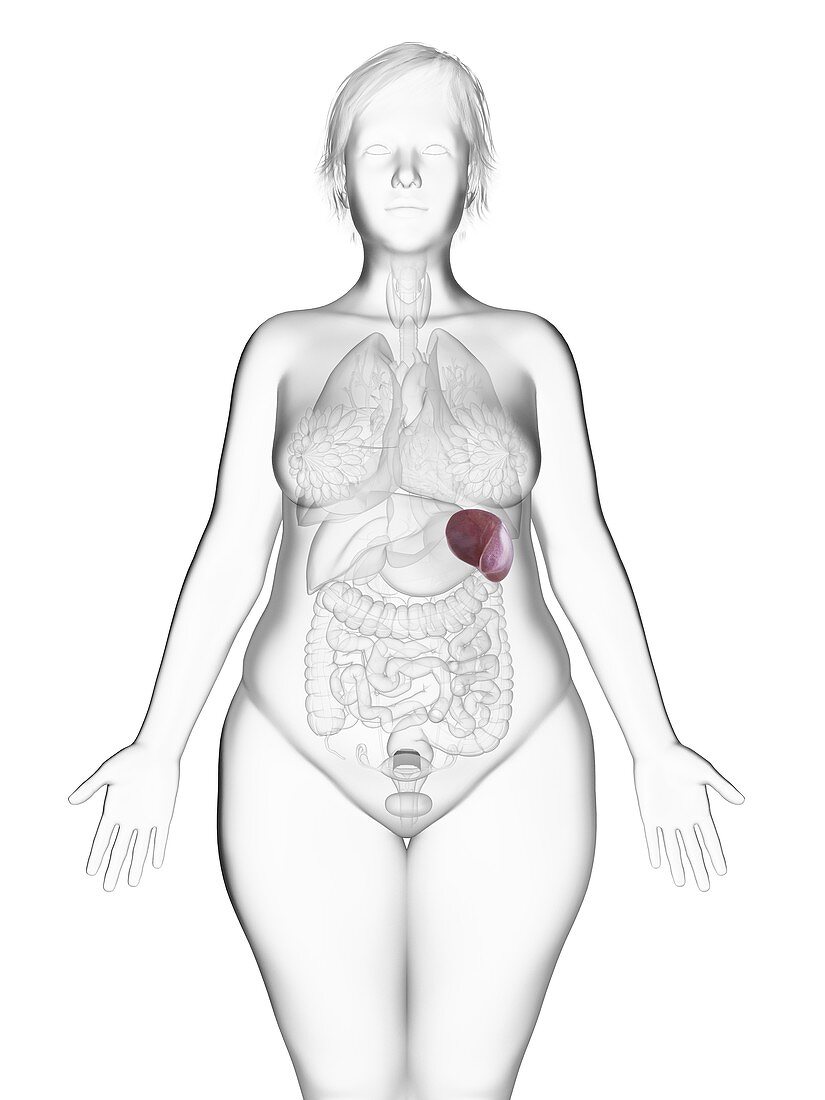 Illustration of an obese woman's spleen