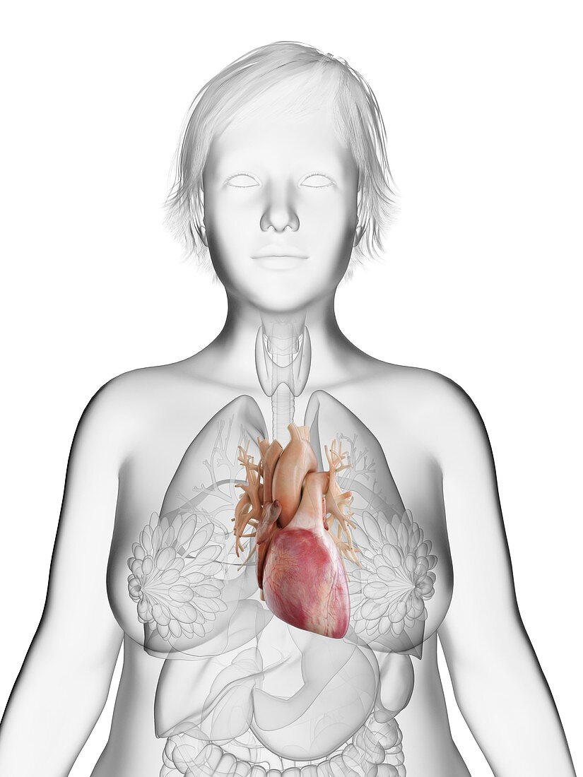 Illustration of an obese woman's heart