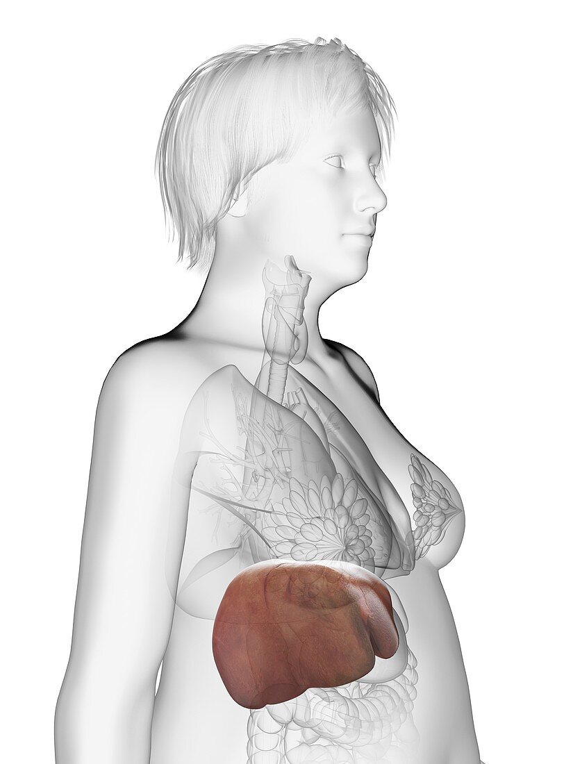 Illustration of an obese woman's liver