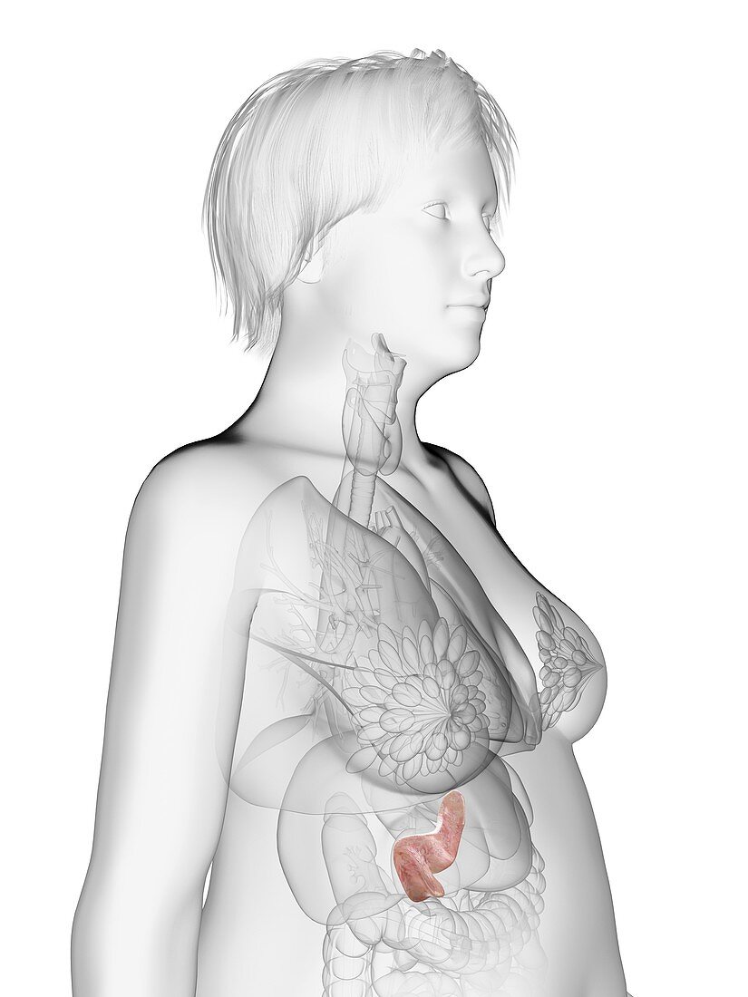 Illustration of an obese woman's pancreas