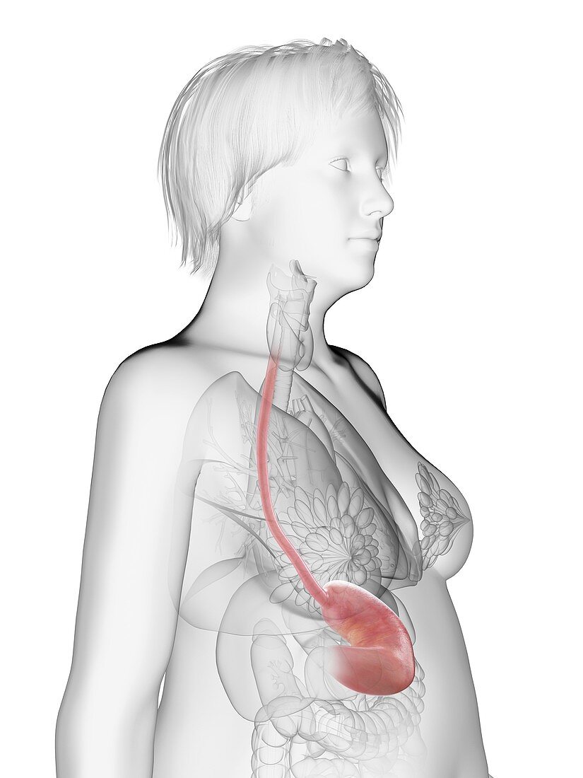 Illustration of an obese woman's stomach