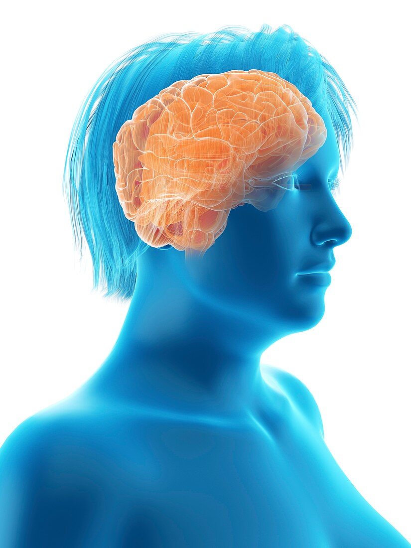 Illustration of an obese woman's brain