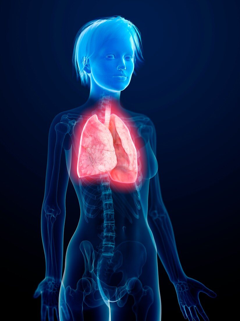 Illustration of an inflamed lung