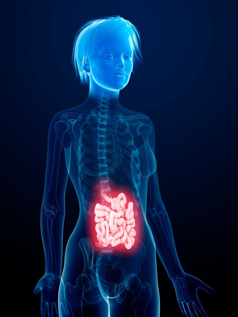 Illustration of an inflamed small intestine