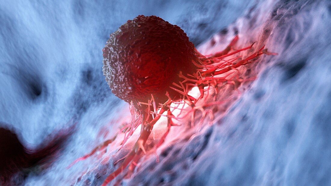 Illustration of a human cancer cell