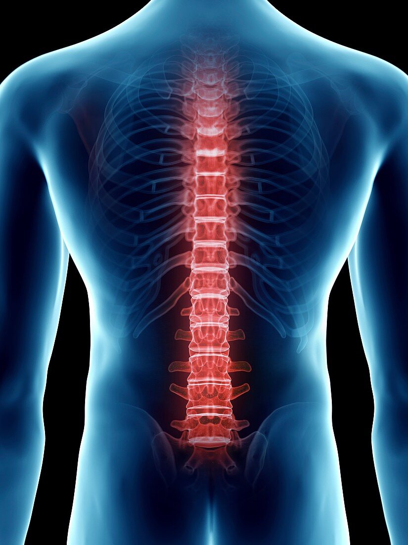 Illustration of a man's painful back