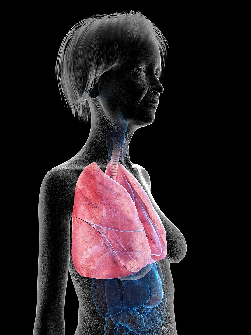 Illustration of an old woman's lung