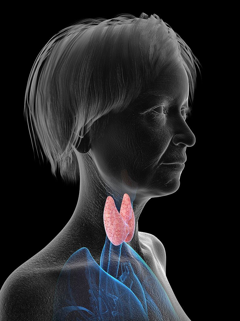 Illustration of an old woman's thyroid gland