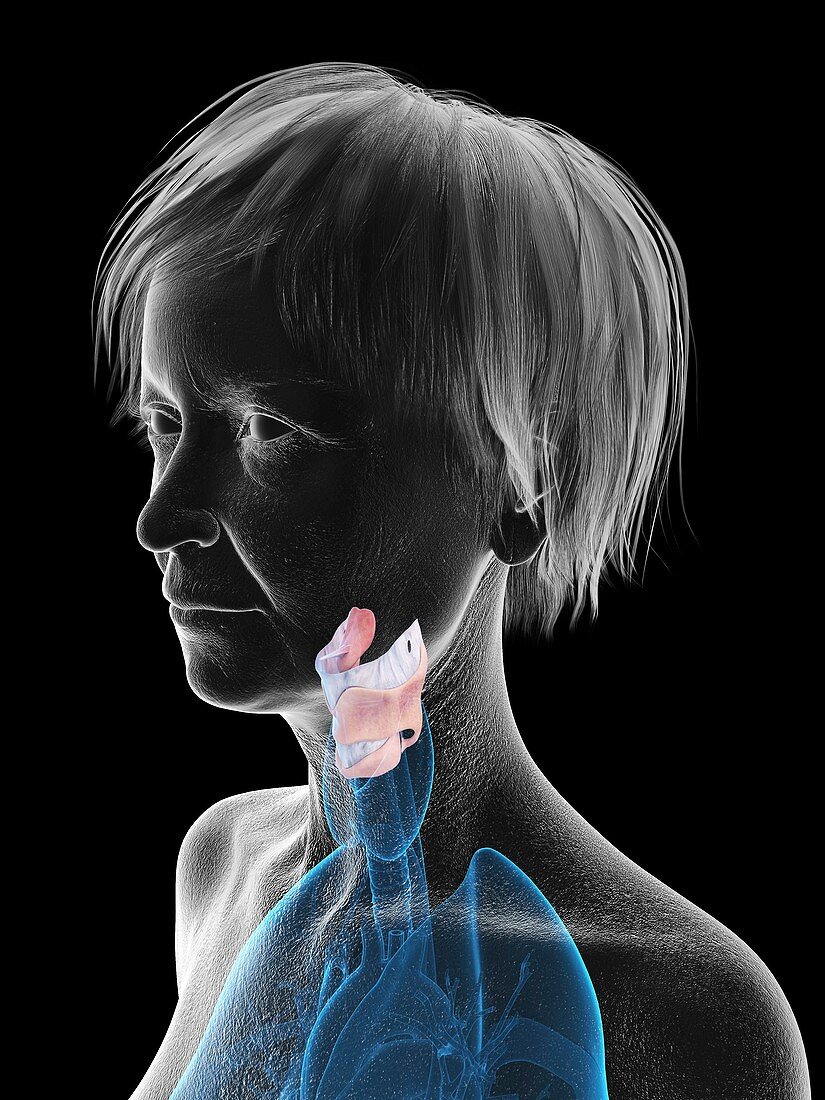 Illustration of an old woman's larynx