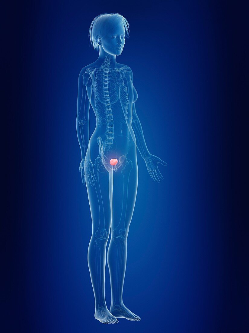 Illustration of a woman's painful bladder