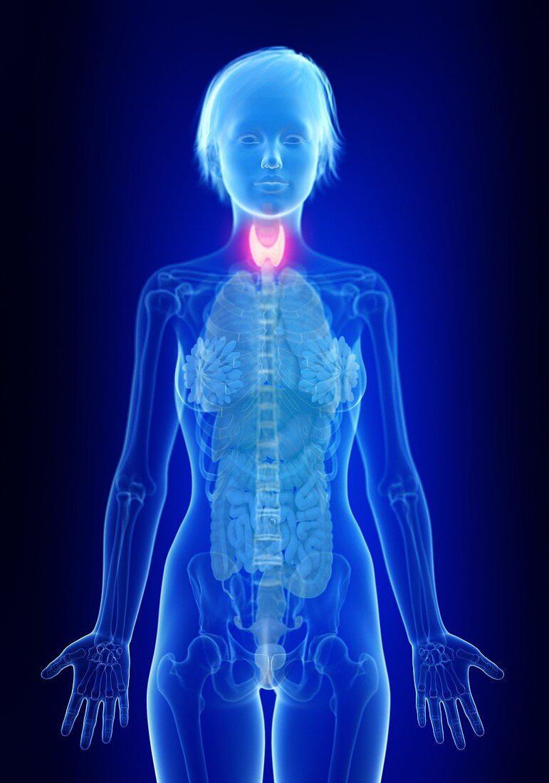 Illustration of an inflamed thyroid gland