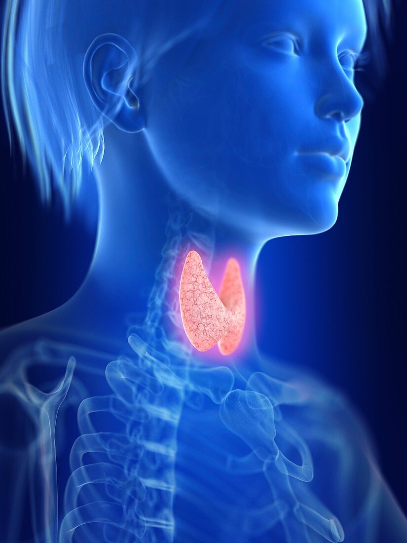 Illustration of an inflamed thyroid