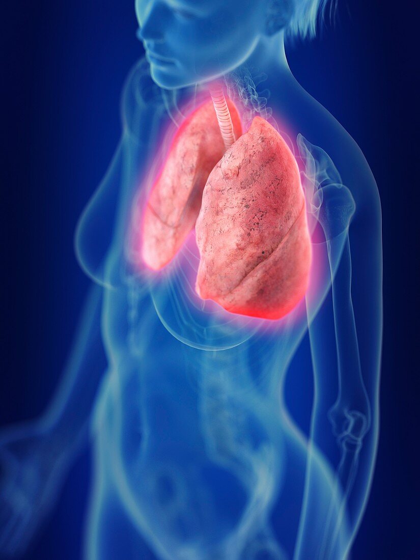 Illustration of an inflamed lung