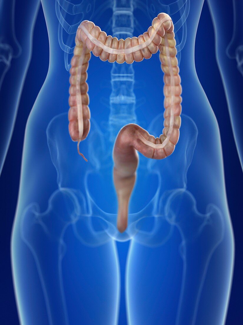 Illustration of a woman's colon