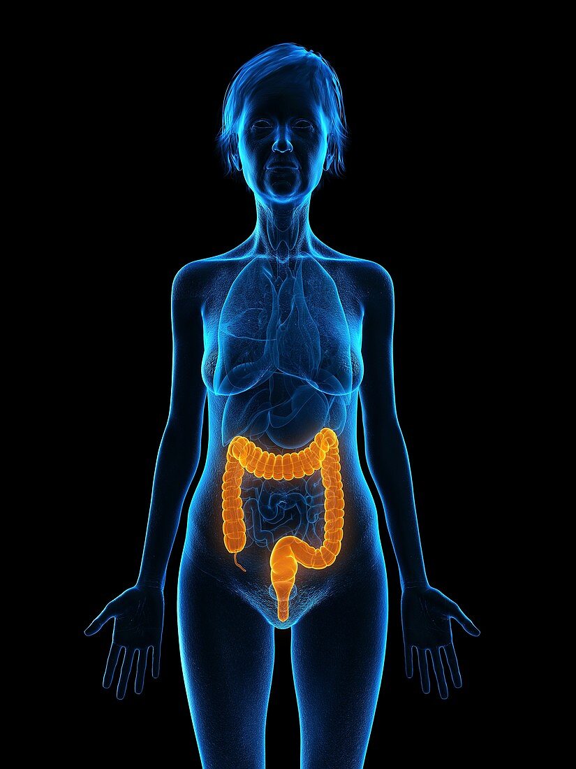 Illustration of an old woman's colon