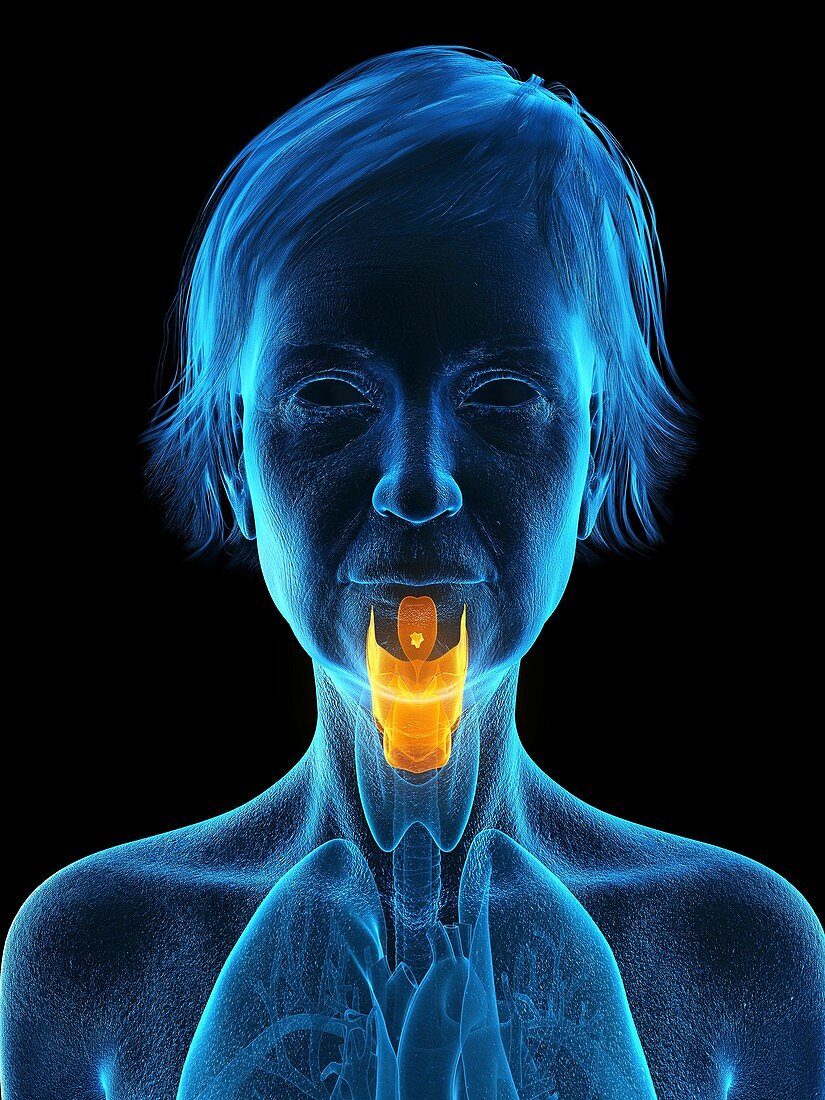 Illustration of an old woman's larynx