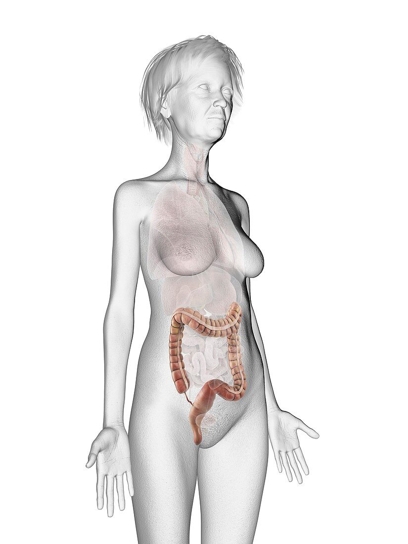 Illustration of an old woman's colon