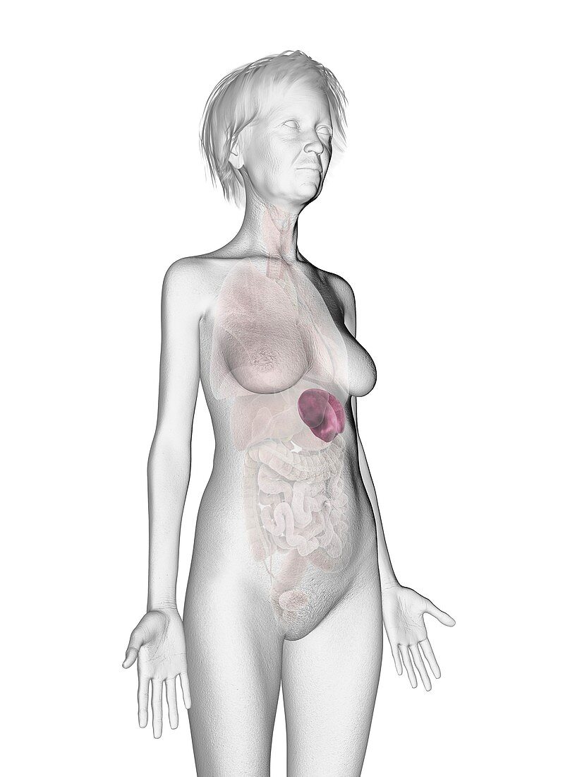 Illustration of an old woman's spleen