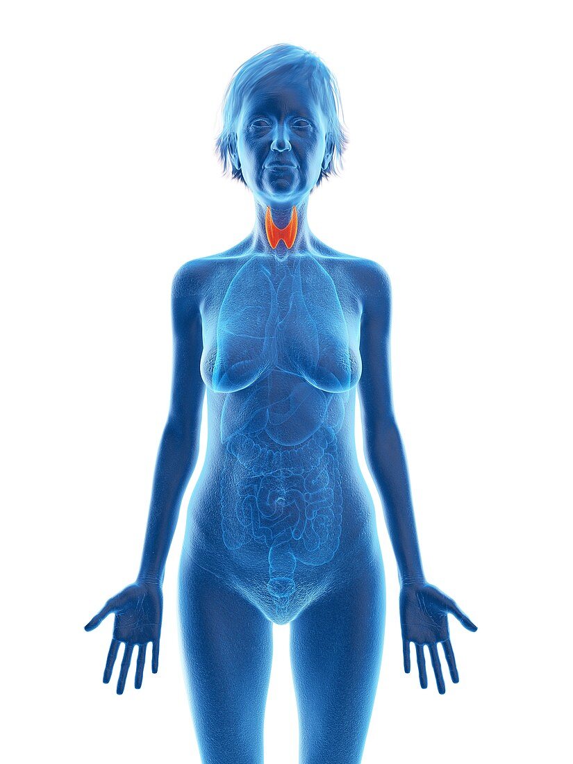 Illustration of an old woman's thyroid