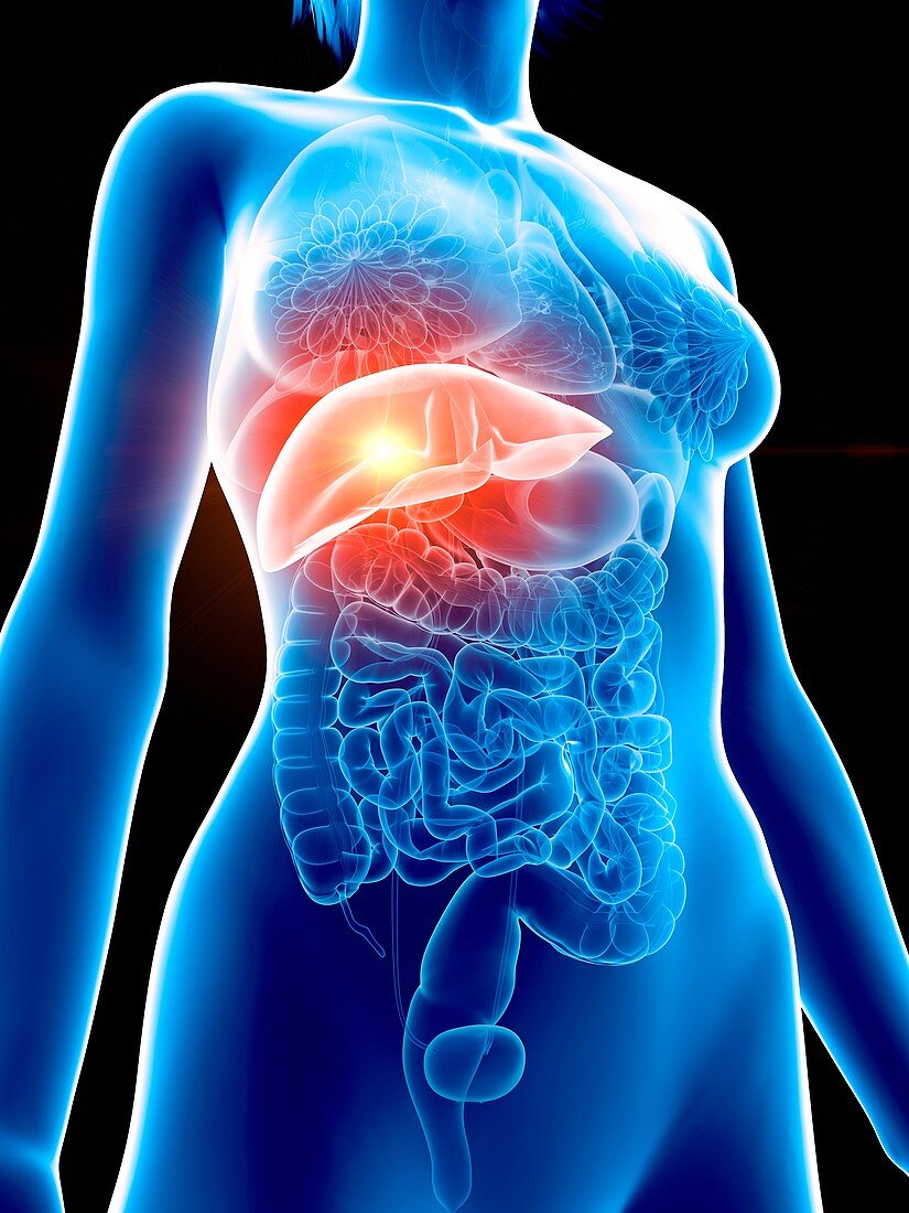 Illustration of a woman's painful liver