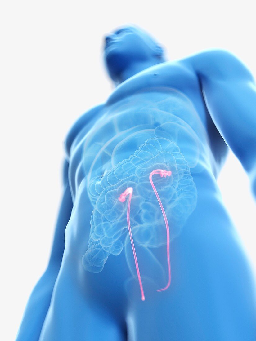 Illustration of a man's ureters