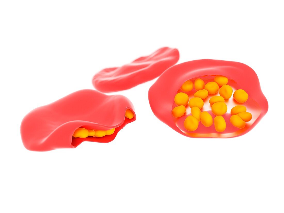 Illustration of malaria infected blood cells