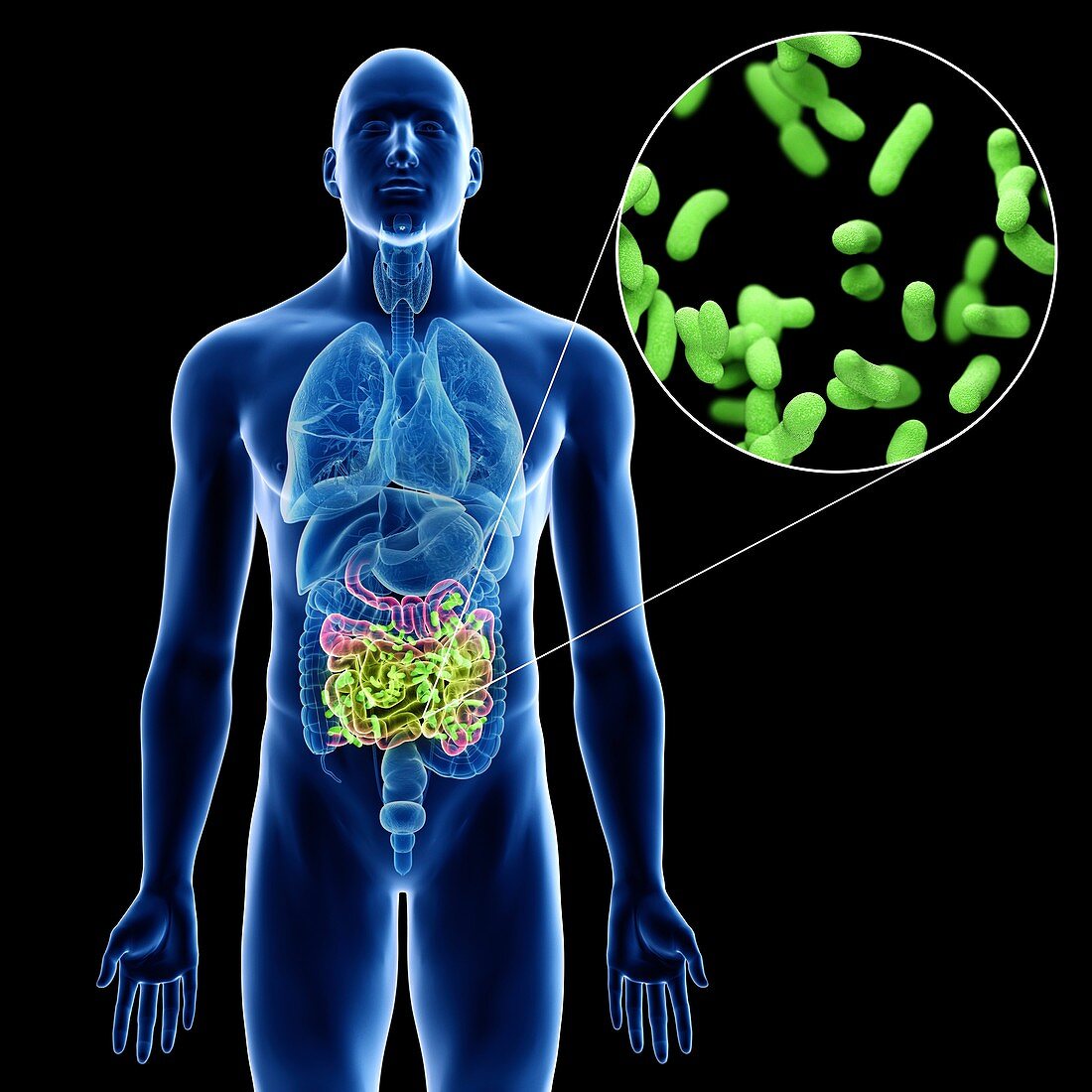 Illustration of a man's small intestine infection