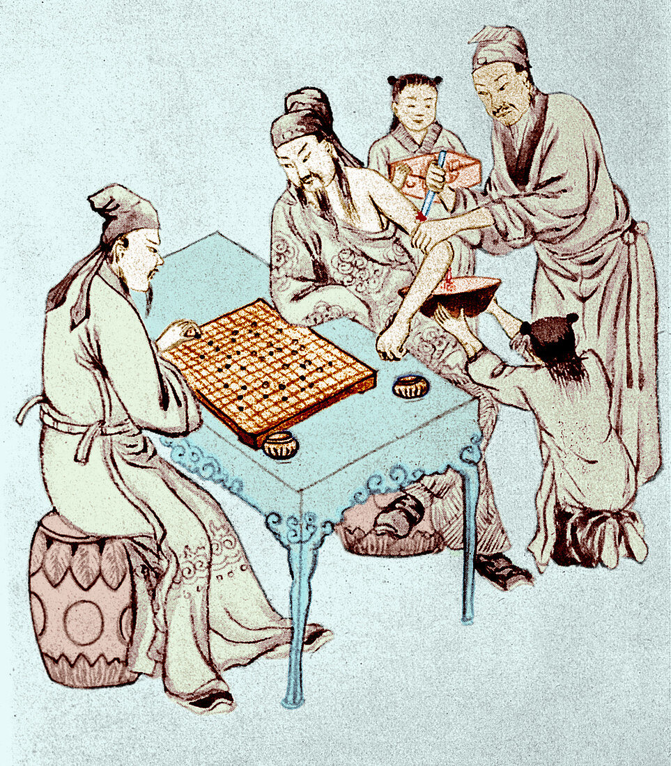 Hua Tuo Operating On Juan Kung, 2nd Century BC