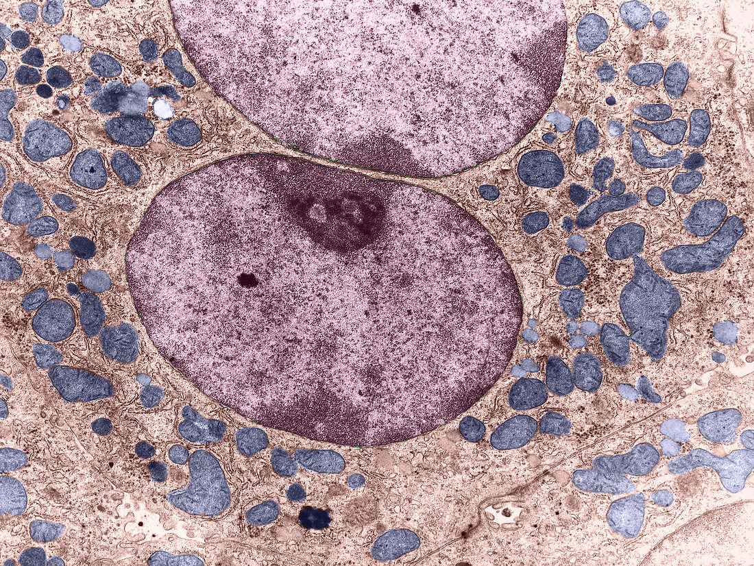 Cell with Organelles (TEM)