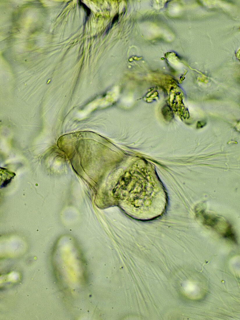 Protozoa (Trichonympha sp.), LM