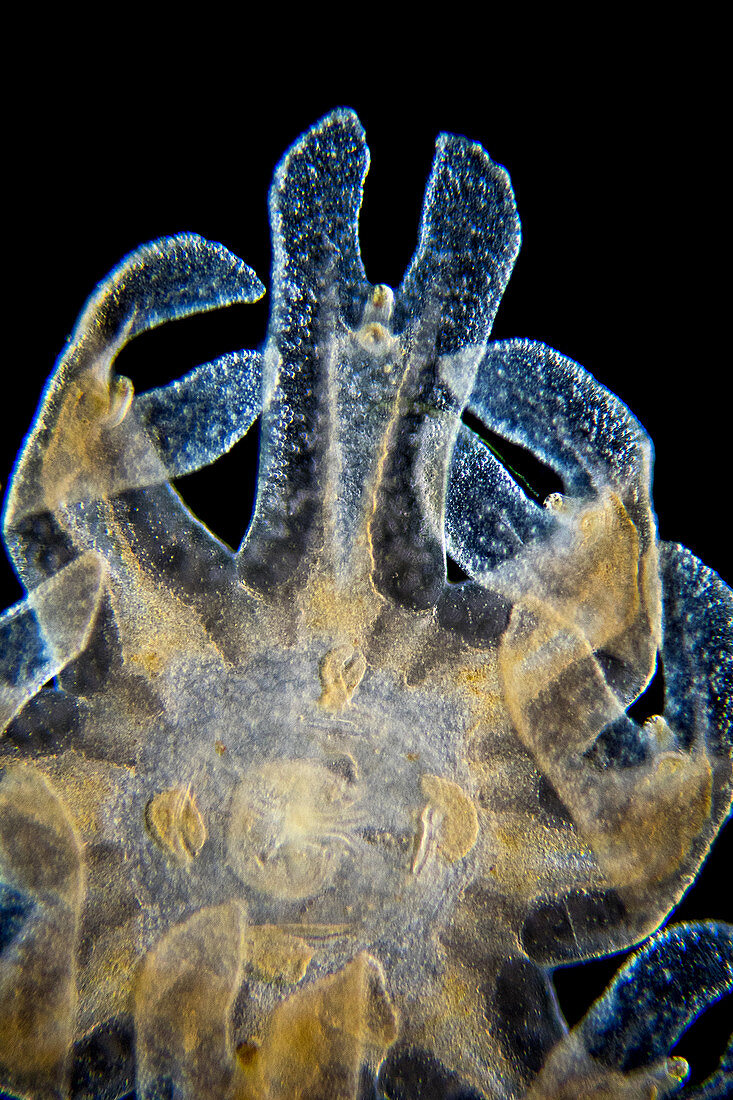 Jellyfish ephyra, LM