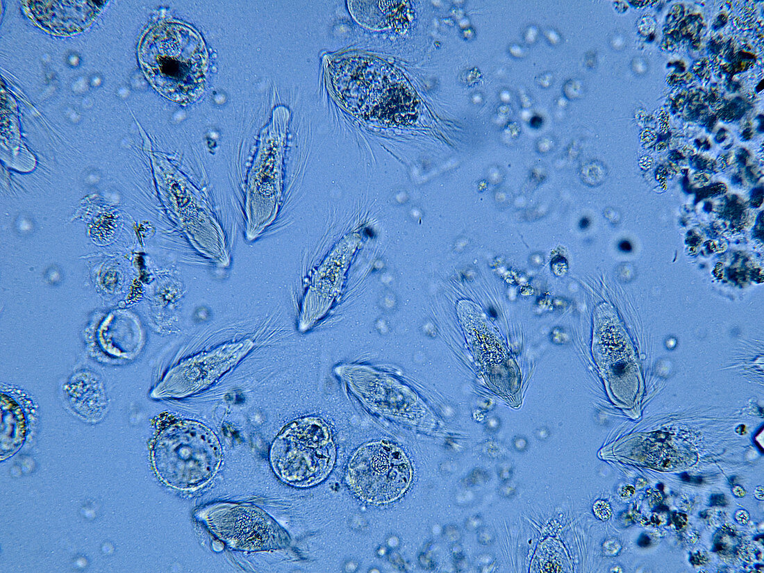 Protozoa (Trichonympha sp.), LM
