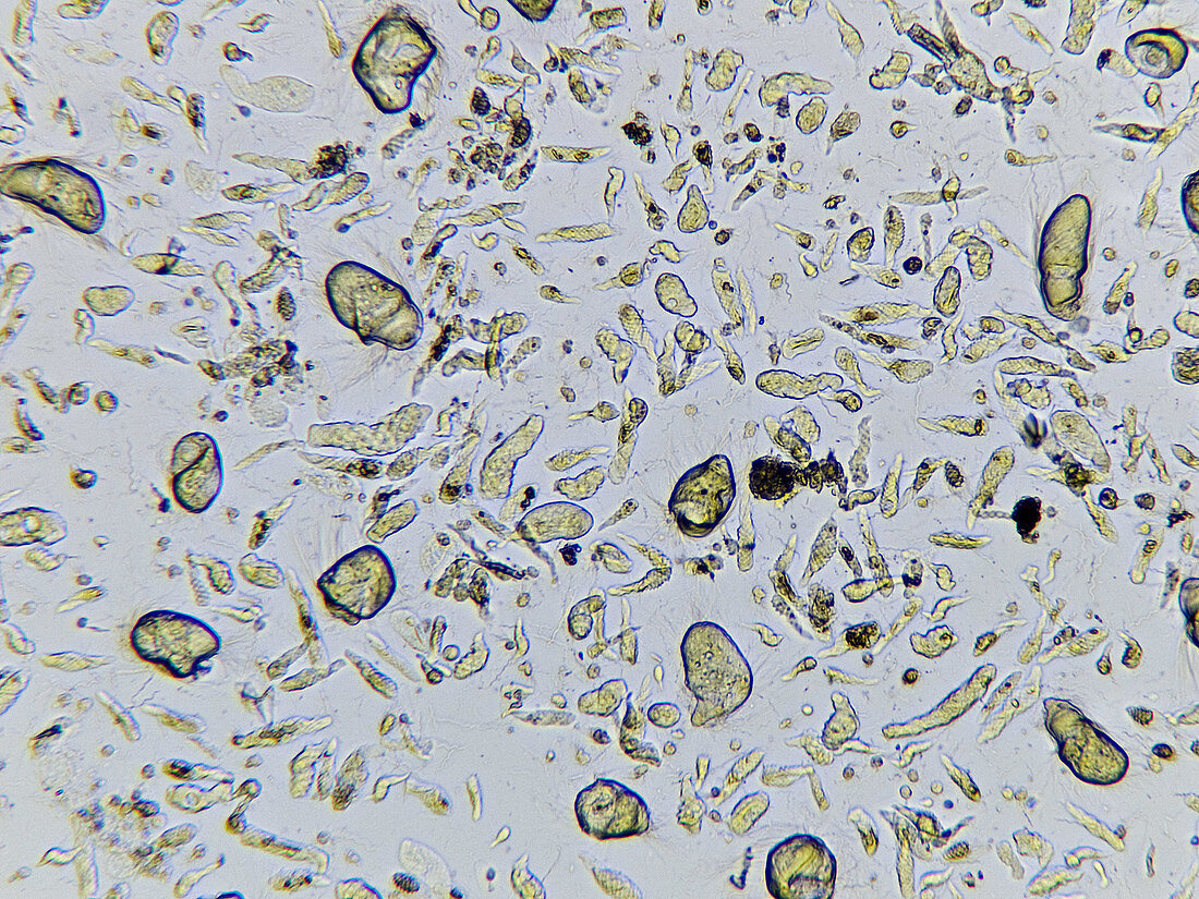 Symbiotic protozoa in termite gut, LM