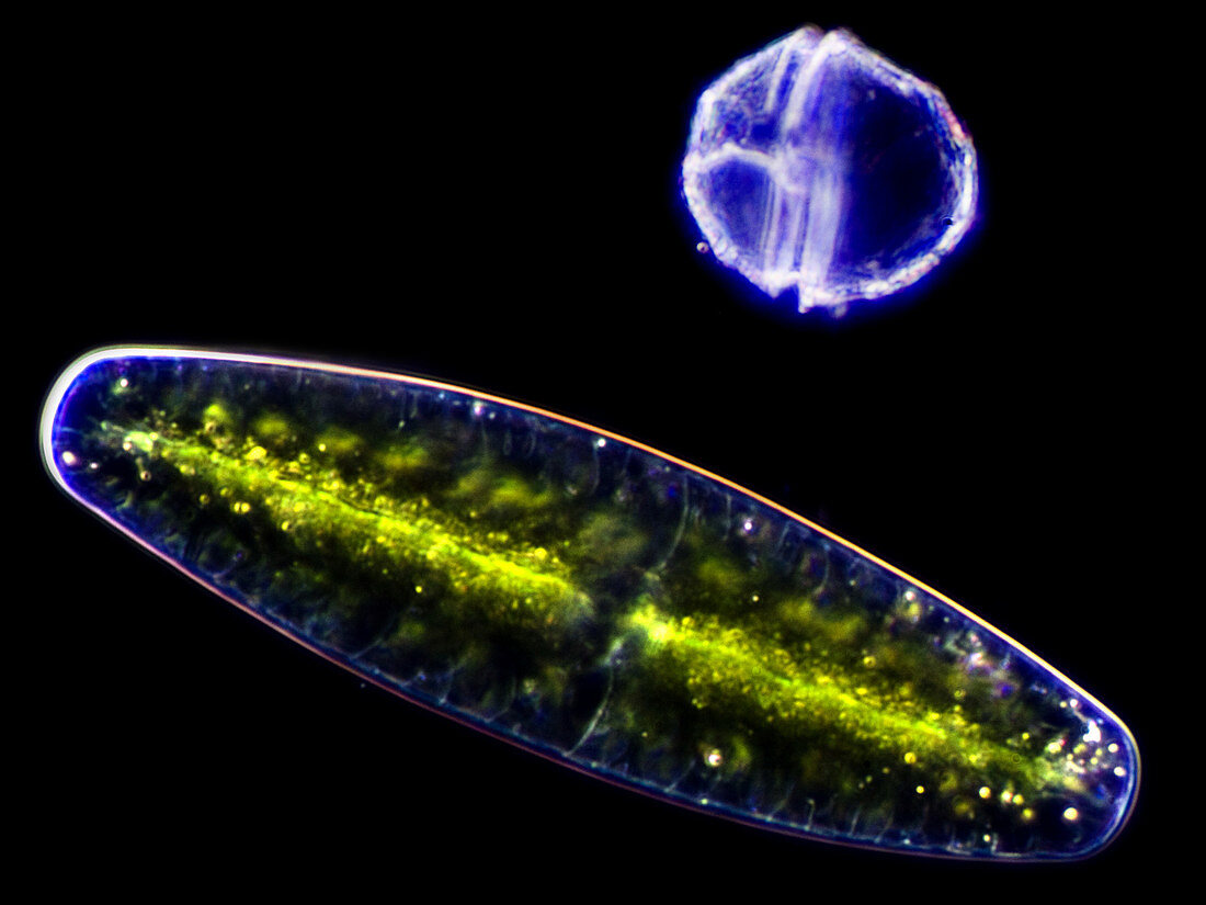 Green algae & dinoflagellate, LM