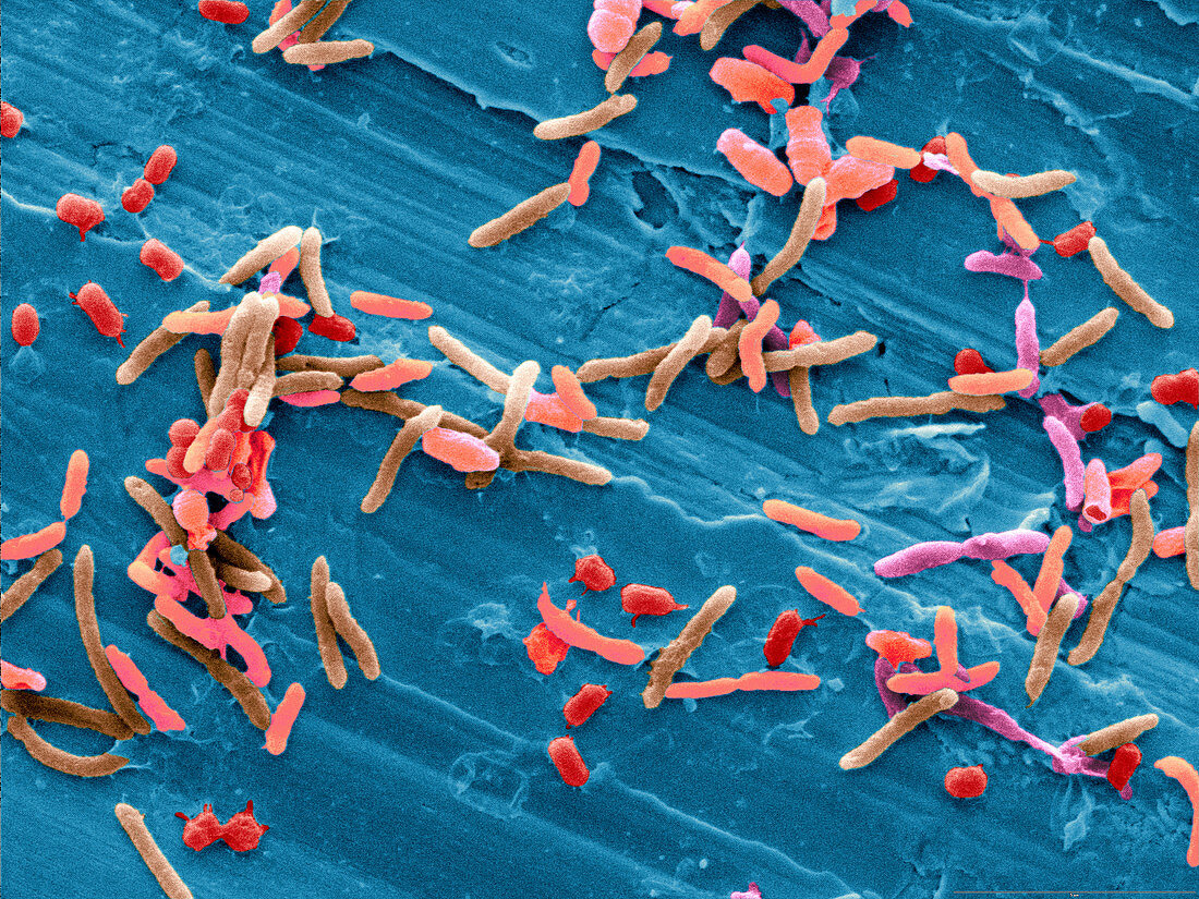 Bacteria from Raw Chicken Meat, SEM
